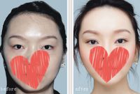 美莱医院好不好