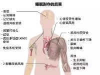 喜临门丨我的瞌睡虫去哪儿了