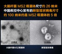 专家建议宅家防护也要注意“病从口入”