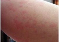 入住新家频繁生病、绿植枯萎,小心甲醛在作祟