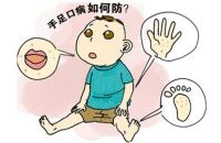 手足口病怎么预防 手足口病饮食注意事项
